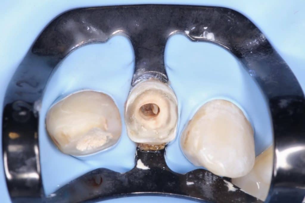 826A3D21-10B3-4EF0-8AAC-A02CCF228337