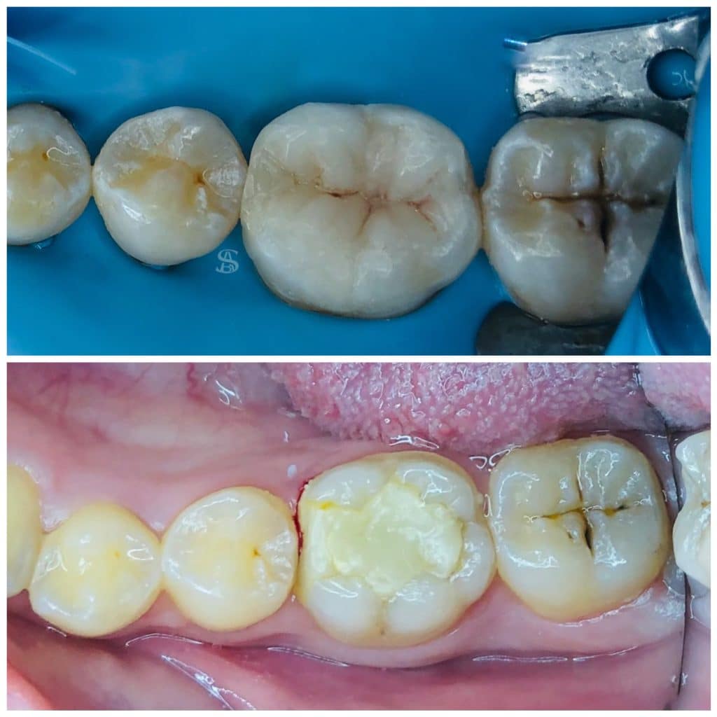 B90BFC46-FB4E-4183-A6B5-1714B2AE9FD0