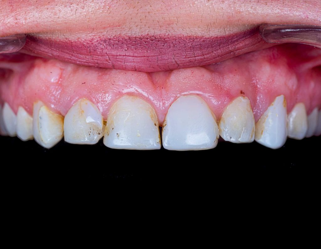 FB_IMG_1691143258175