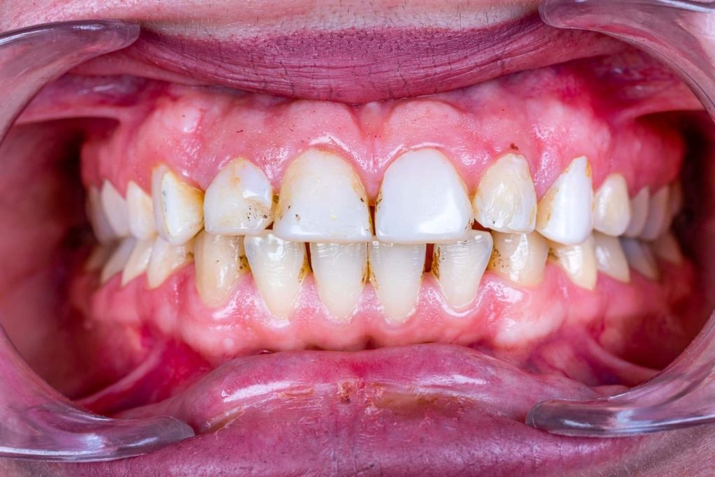 FB_IMG_1691143260441