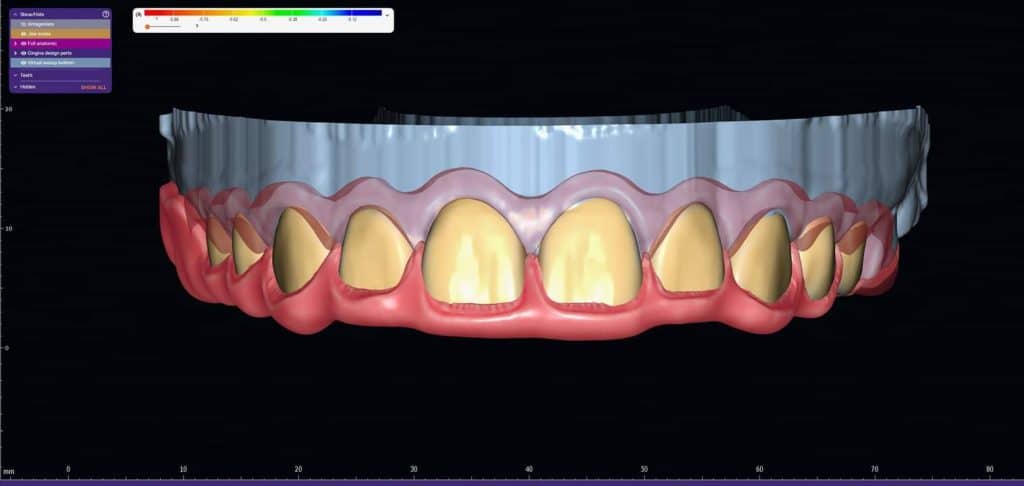 FB_IMG_1691143270121