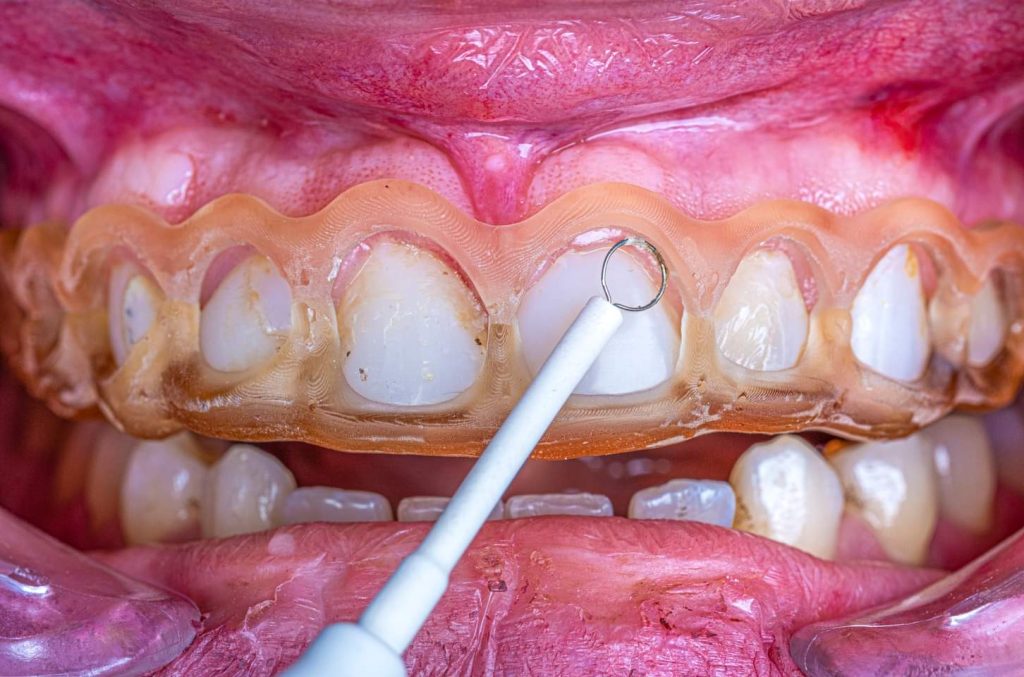 FB_IMG_1691143286172