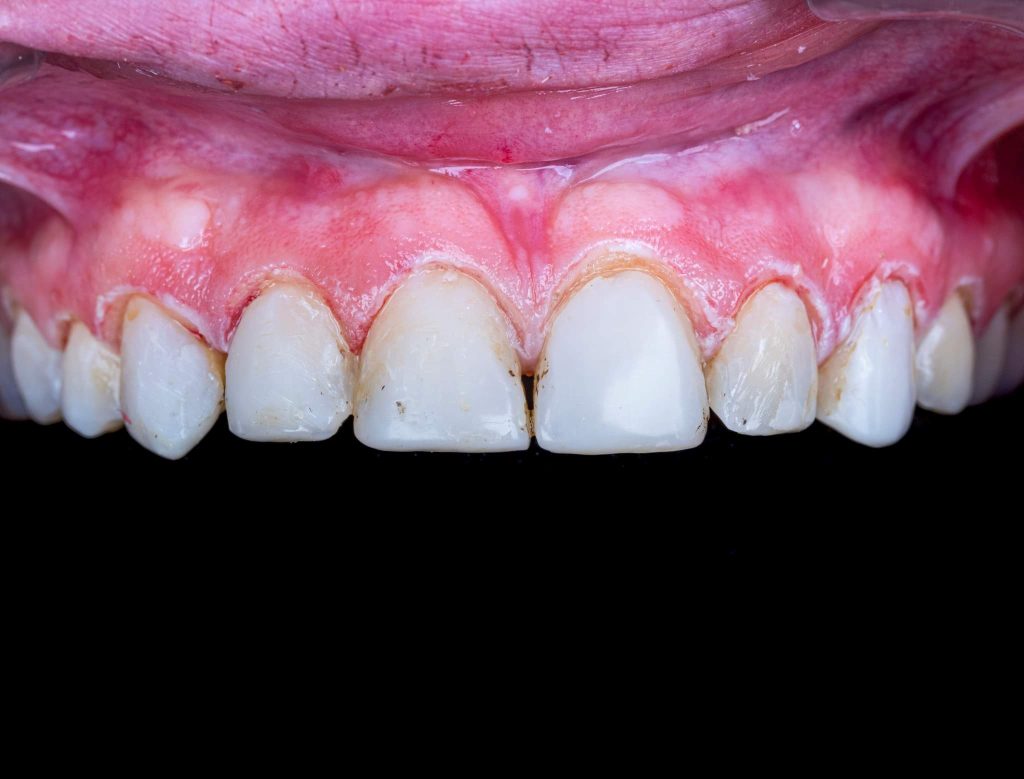 FB_IMG_1691143288570