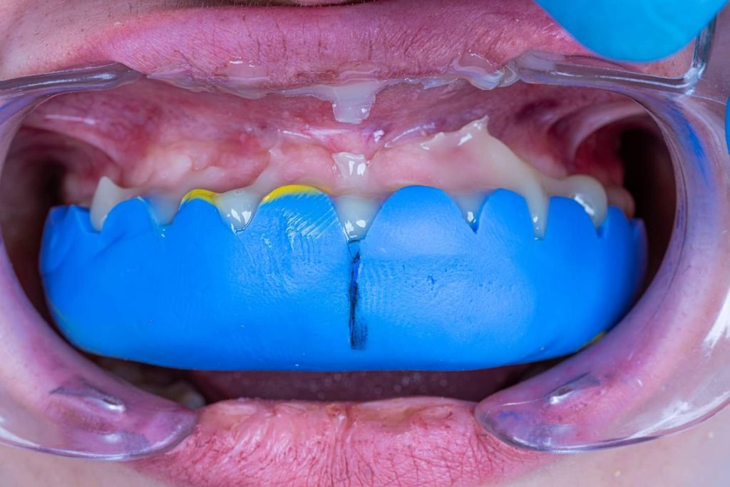 FB_IMG_1691143291335