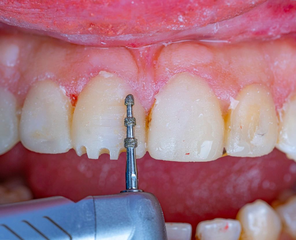 FB_IMG_1691143298827