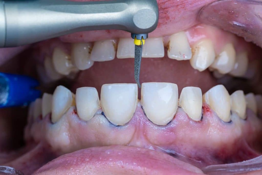 FB_IMG_1691143307609