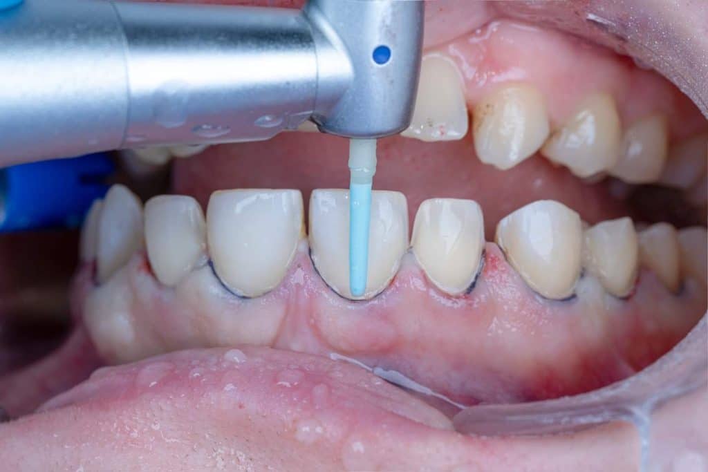 FB_IMG_1691143312725