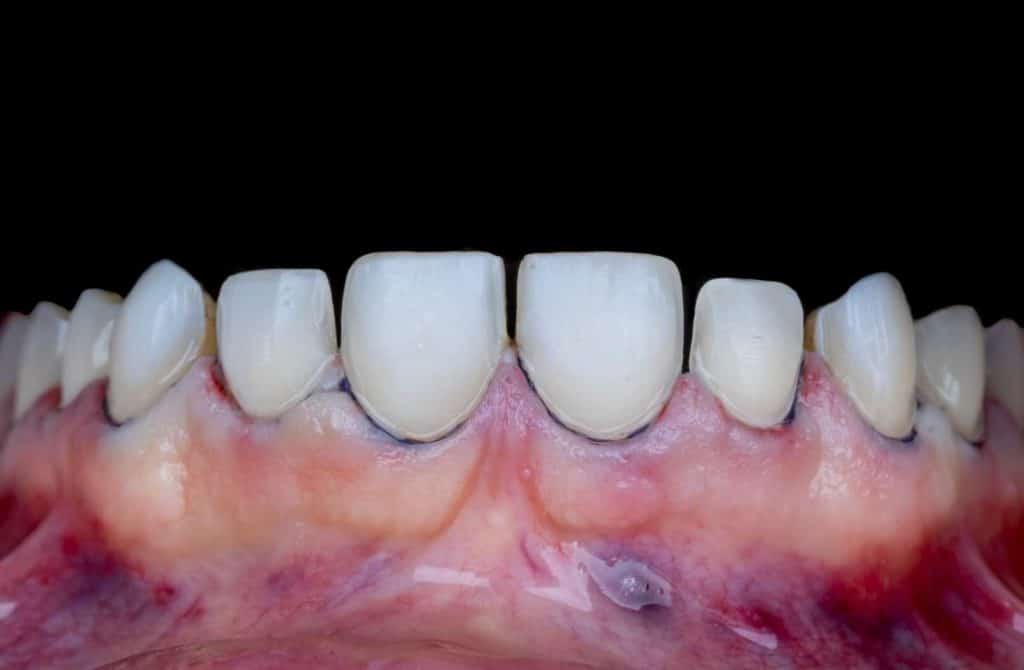 FB_IMG_1691143314974