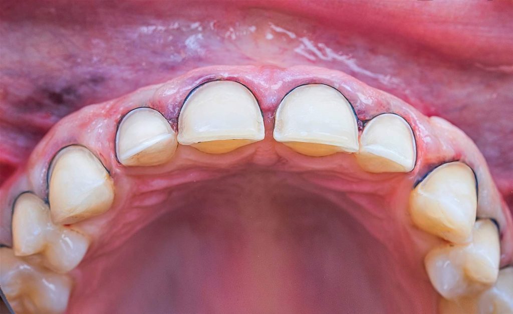 FB_IMG_1691143317508