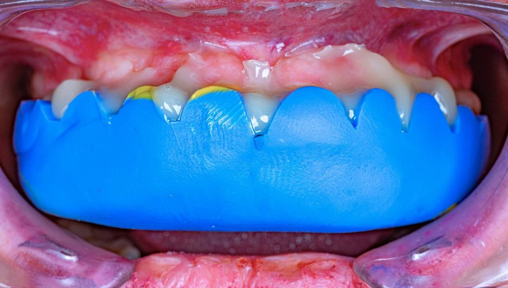 FB_IMG_1691143322023