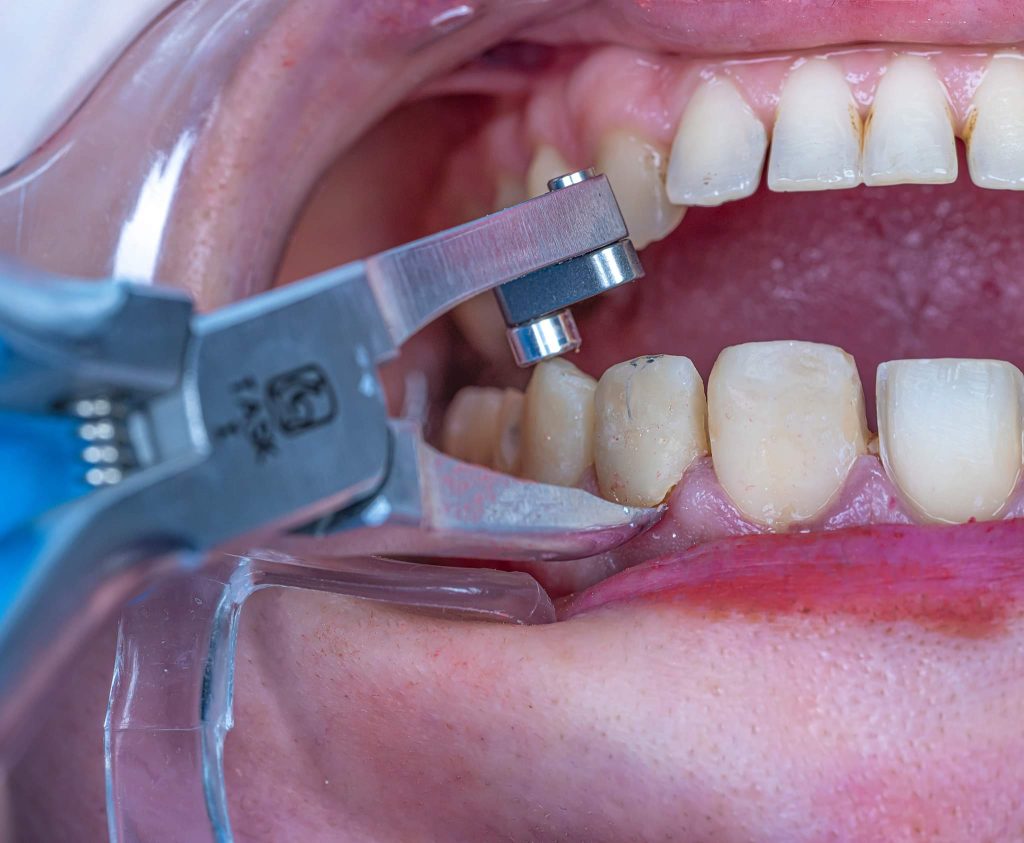 FB_IMG_1691143329104