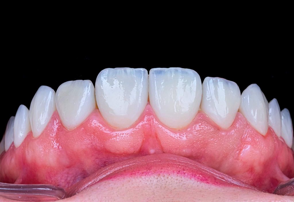 FB_IMG_1691143366287