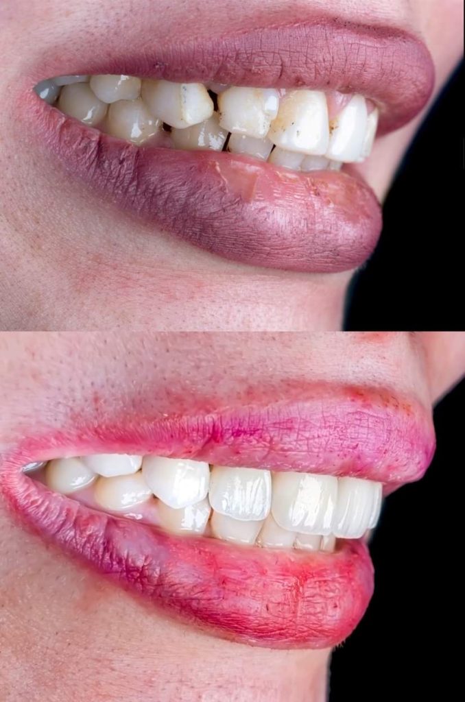 FB_IMG_1691143375948