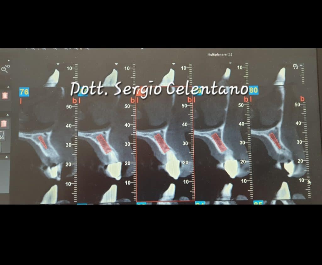 Screenshot_20220304-165624_Gallery