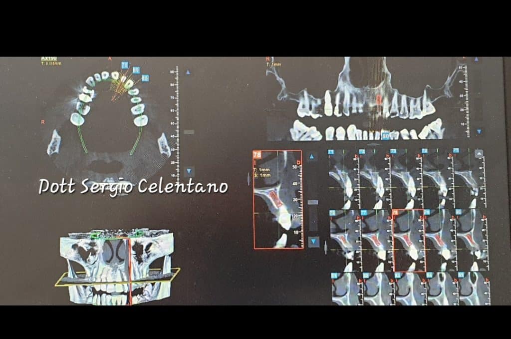 Screenshot_20220304-165705_Gallery