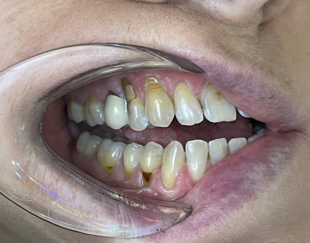 Initial clinical situation