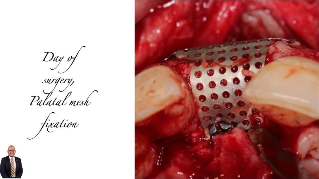 0039C585-6A09-48B9-BA45-BD5A2D46449D