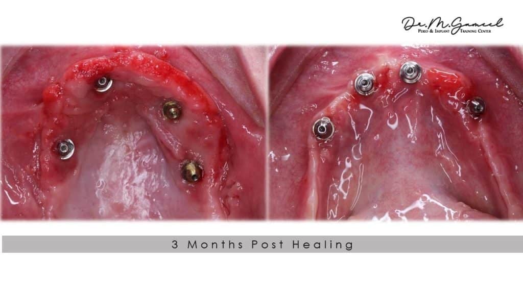 0F0FF99B-F757-4F4B-8E50-EE48B19F197D