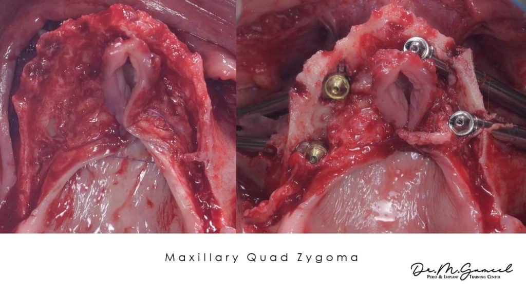 1B751EEE-1883-4F08-8EAB-5A5DB230D212