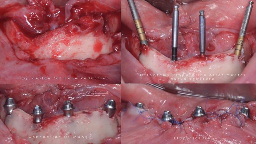 202B4F22-3A27-4814-962B-987DAF3CBE47