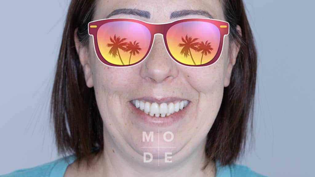 Smile at Follow Up 3 Months