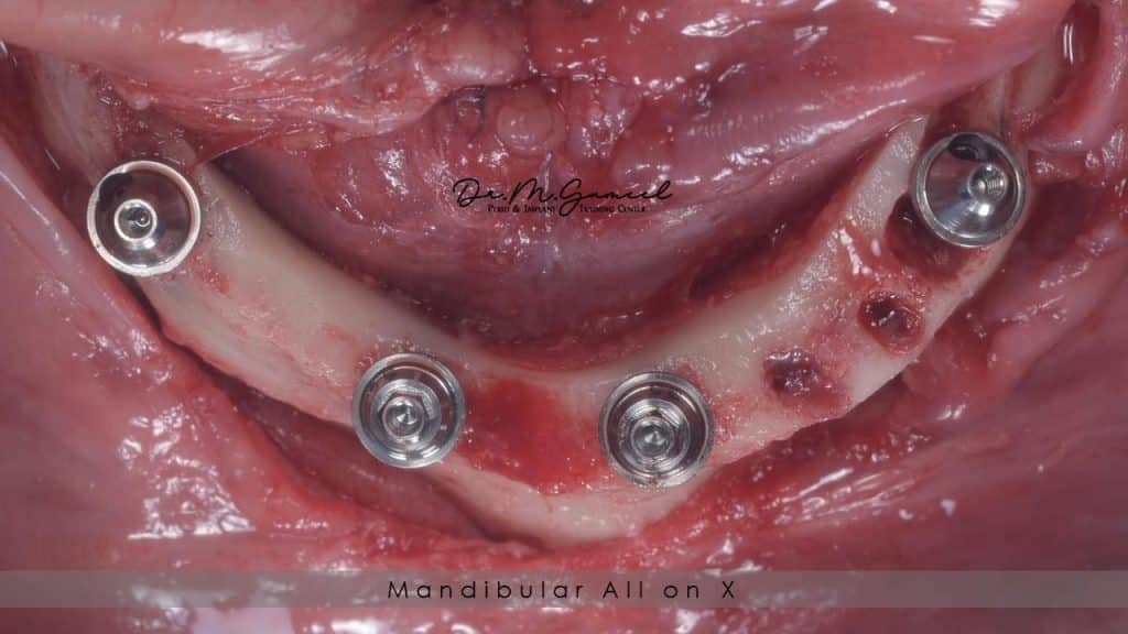 41FEB110-116E-47FB-89C9-45D864A93077