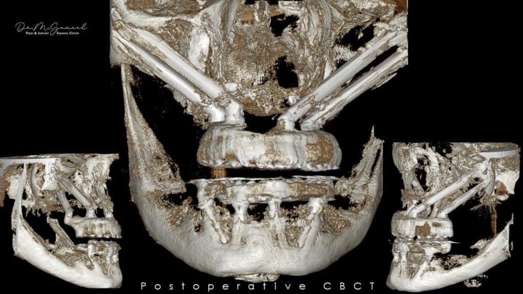 4FB361F3-A61D-4C45-9E9C-32C8F574A9F7