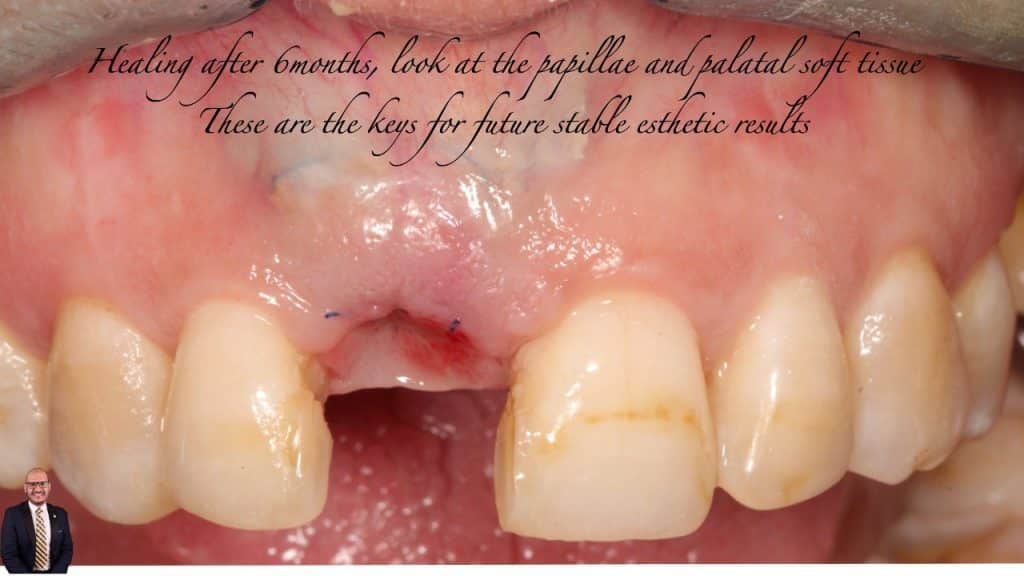 6423127F-9174-447F-A72E-70E46A1649BF