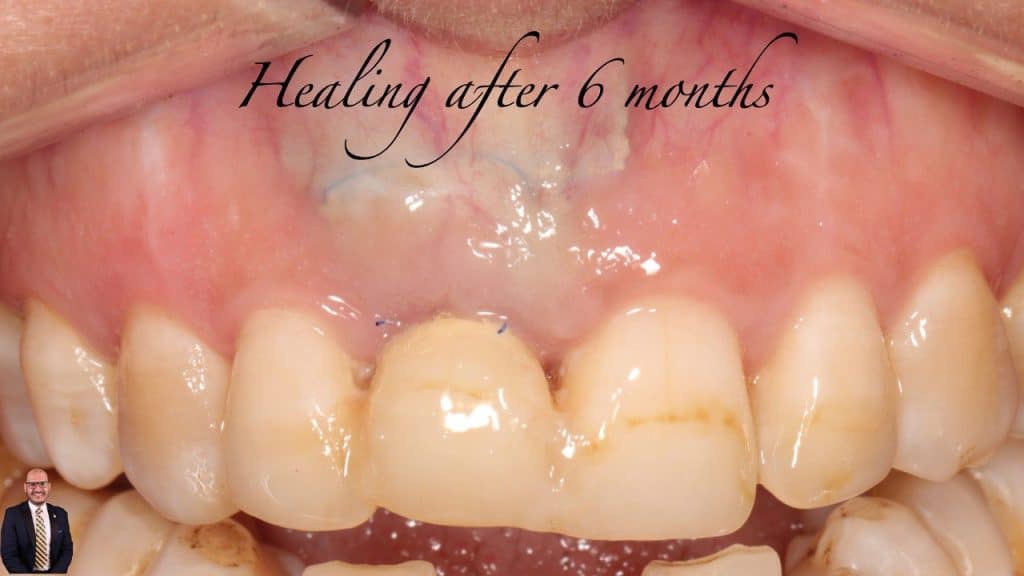 7221FF19-681A-4FEC-B5B2-A22EEF6ADE9A