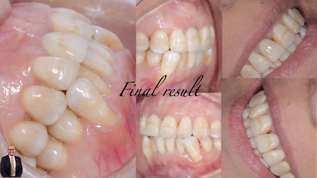 7C9B244C-0ED2-4537-87F5-D1AD9B23A109