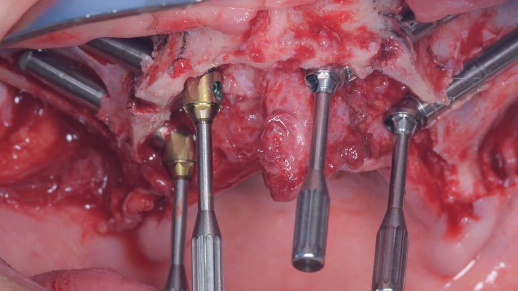 AFC4F365-E460-4817-A445-00AB38A6EE74