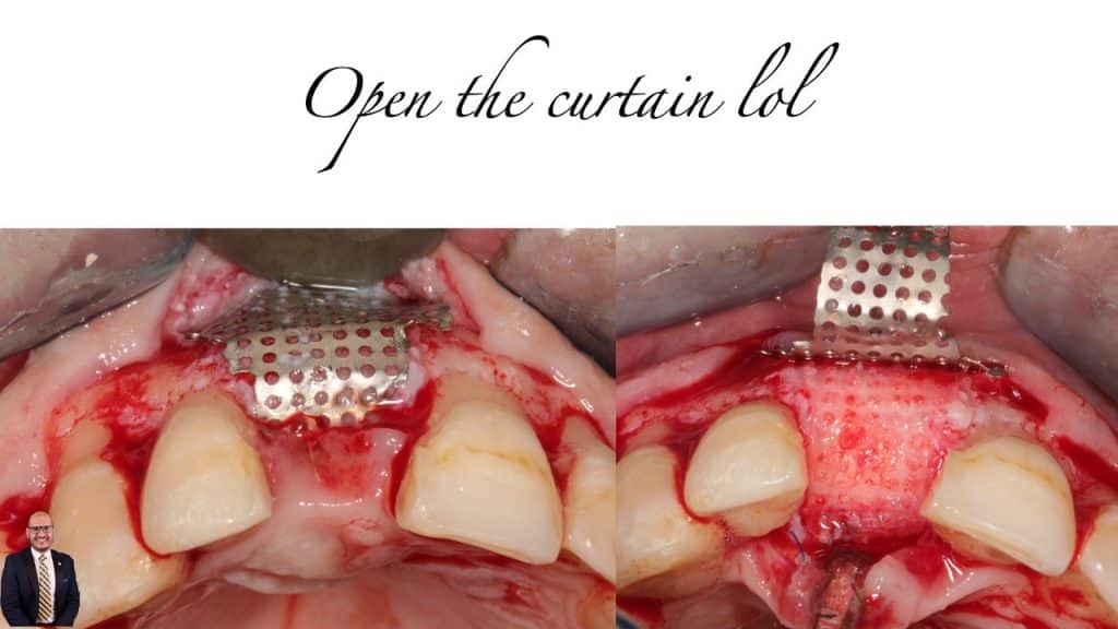 D885EDF3-5475-4B44-8989-B270E980490A