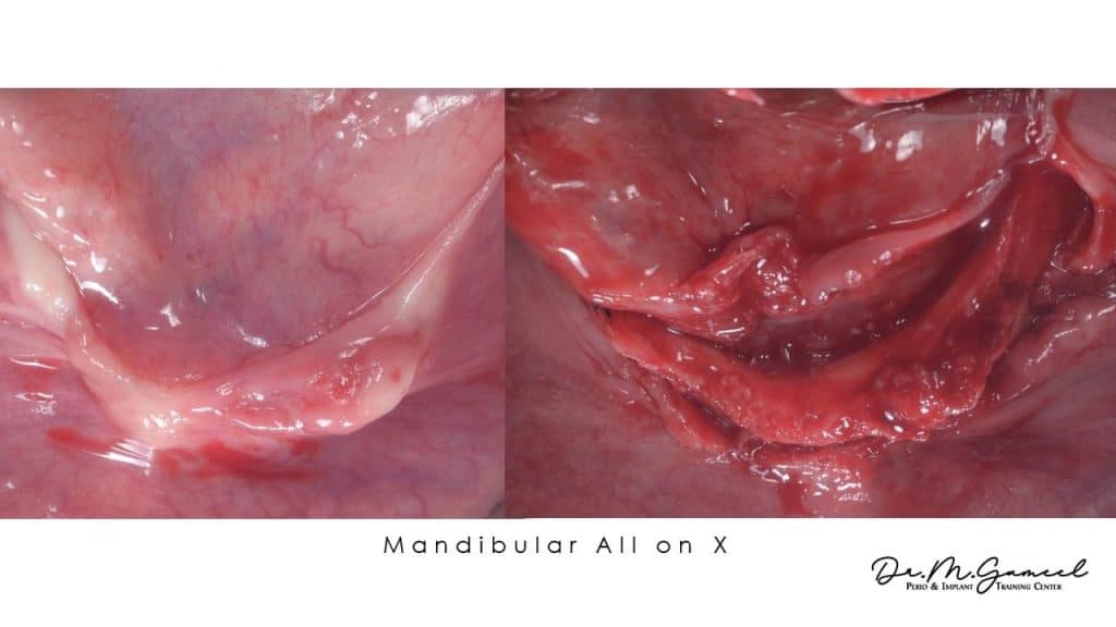 D8A14E0C-99AF-4595-9AC4-2F360A3C1DEB