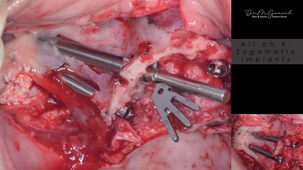 E4F1D02C-50A9-4C24-9BAD-149D55BBDA3B