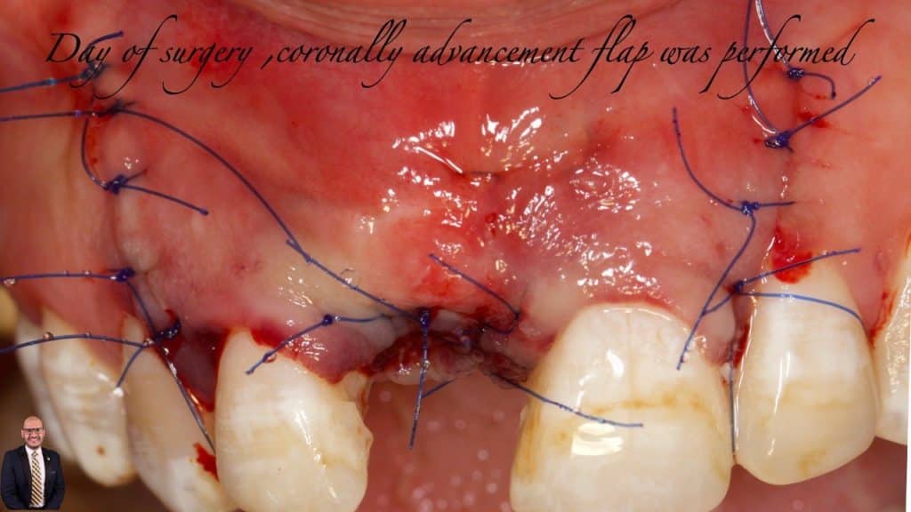 FB0298CE-D3D9-4B19-B06F-5EA3335AFDD9