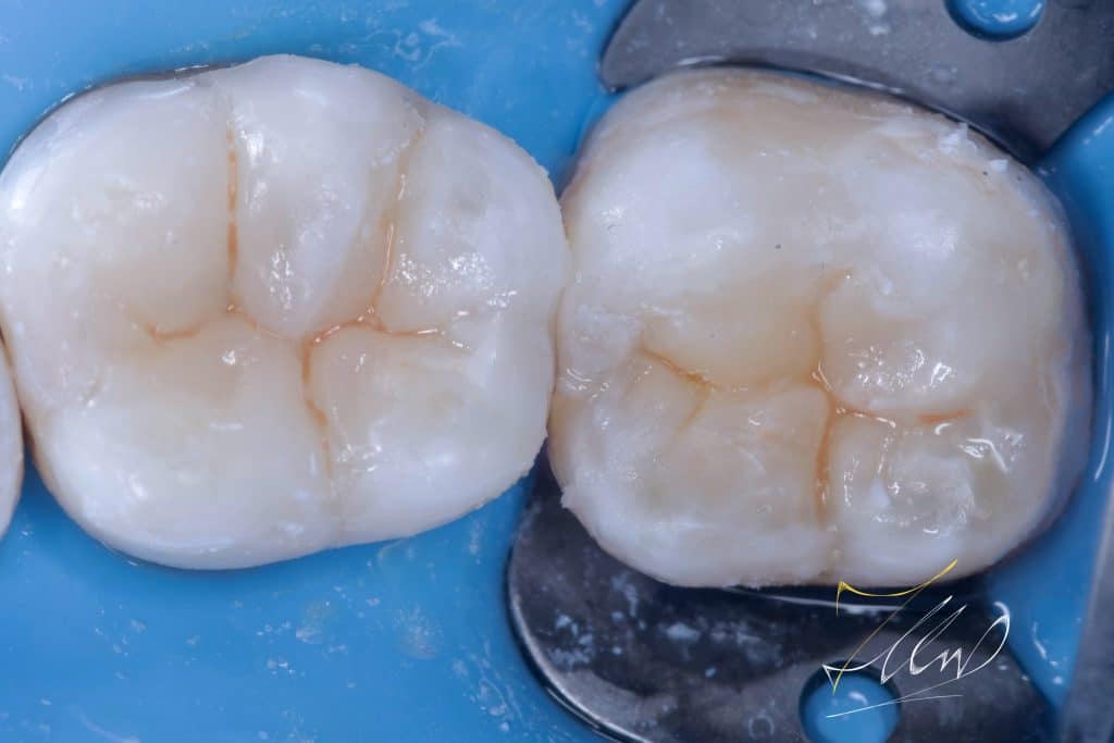 21B151AF-1263-4C9B-9CF1-29CBEAC96737