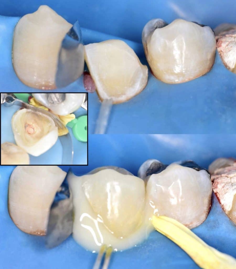 AA9D2517-A12B-4E1E-82C7-D11A5EB3BF47