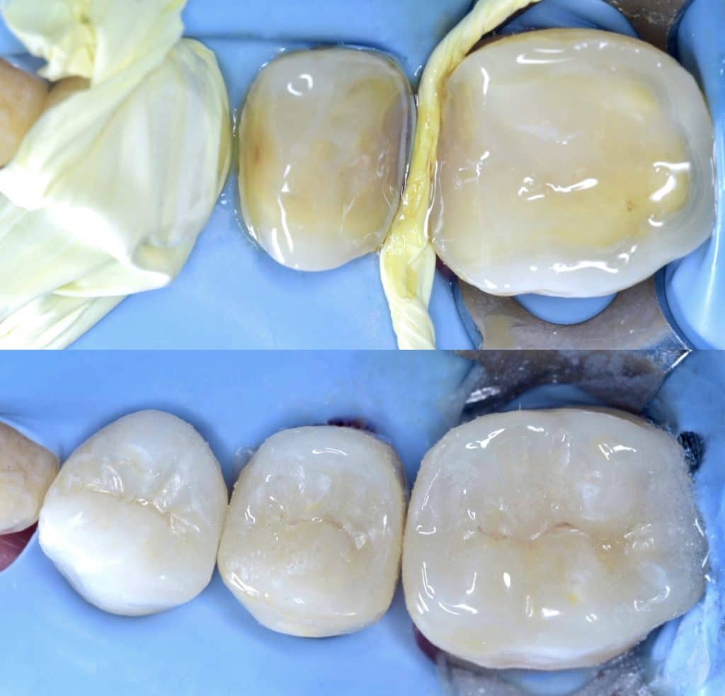 ABBA01BB-DEFB-4F54-9CF2-347C19AA6EB3