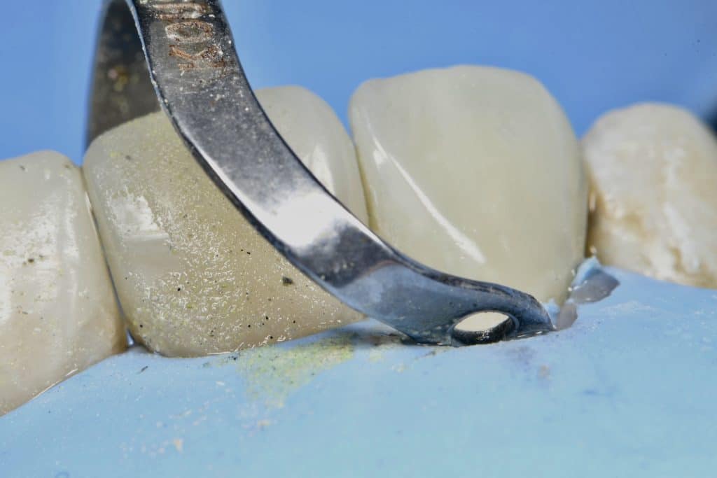 B3234F5C-93BA-404D-B0A1-C95E8BC1887E