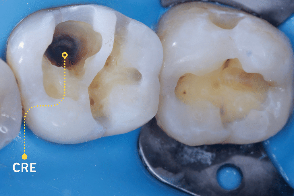 D25E555A-56CD-44CF-ABB6-A91EA5C0A892