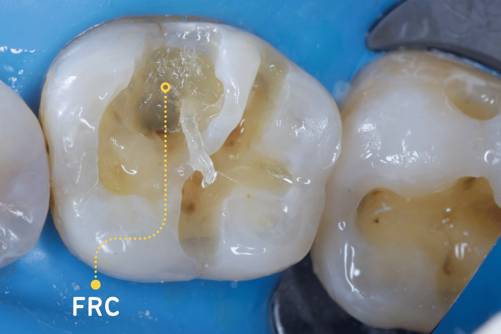 DFEC3F01-E4D9-493B-997D-335AD65DC574