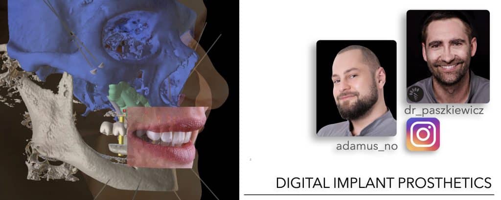 ‎Michalska FULL.‎002