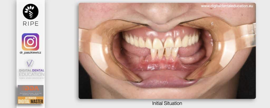 ‎Michalska FULL.‎013