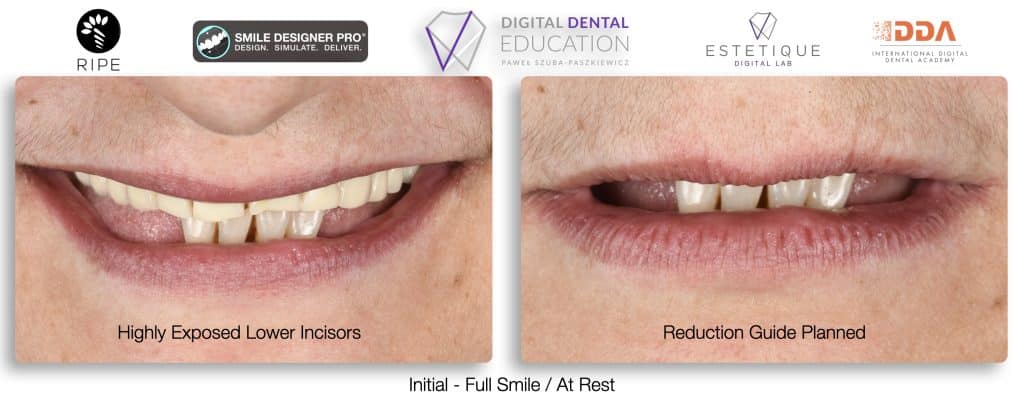 ‎Michalska FULL.‎014