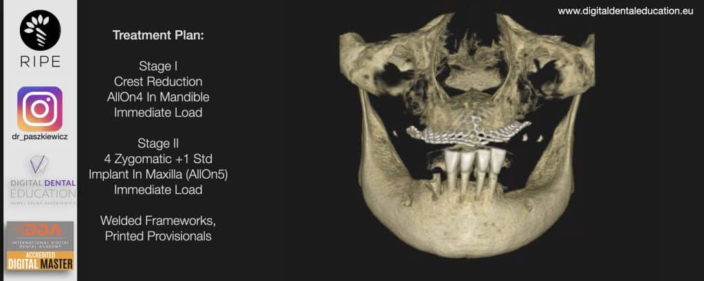 ‎Michalska FULL.‎025