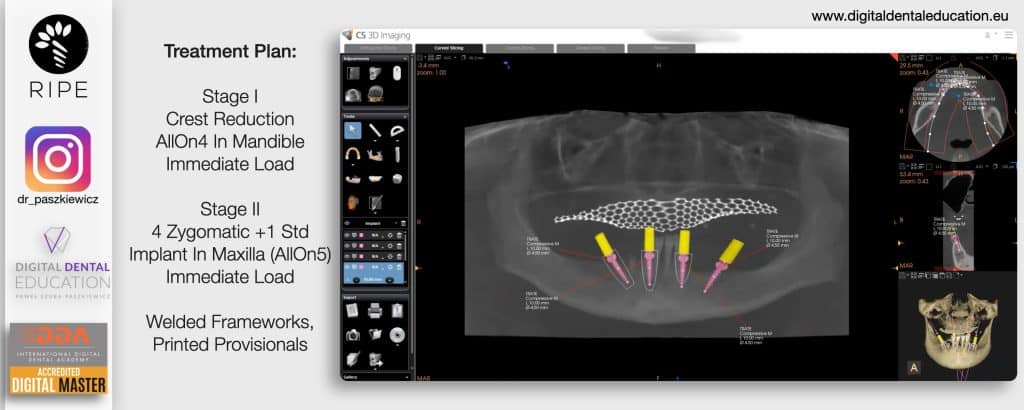 ‎Michalska FULL.‎027