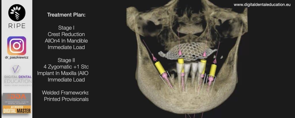 ‎Michalska FULL.‎028