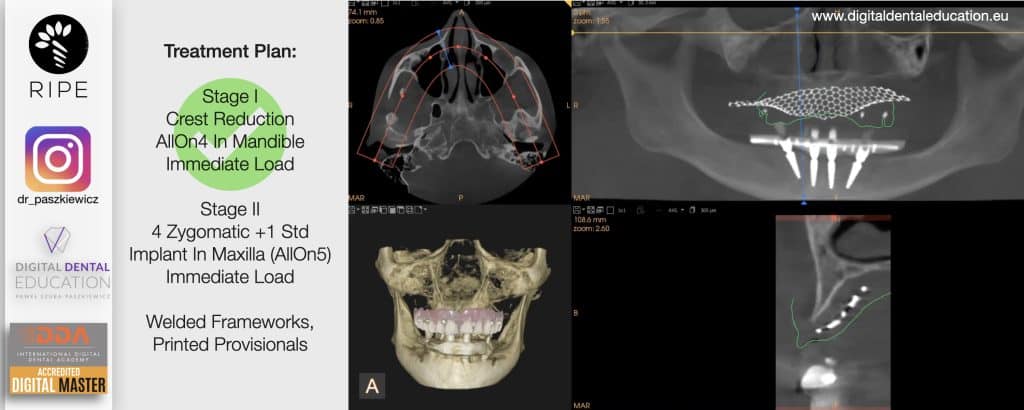 ‎Michalska FULL.‎030