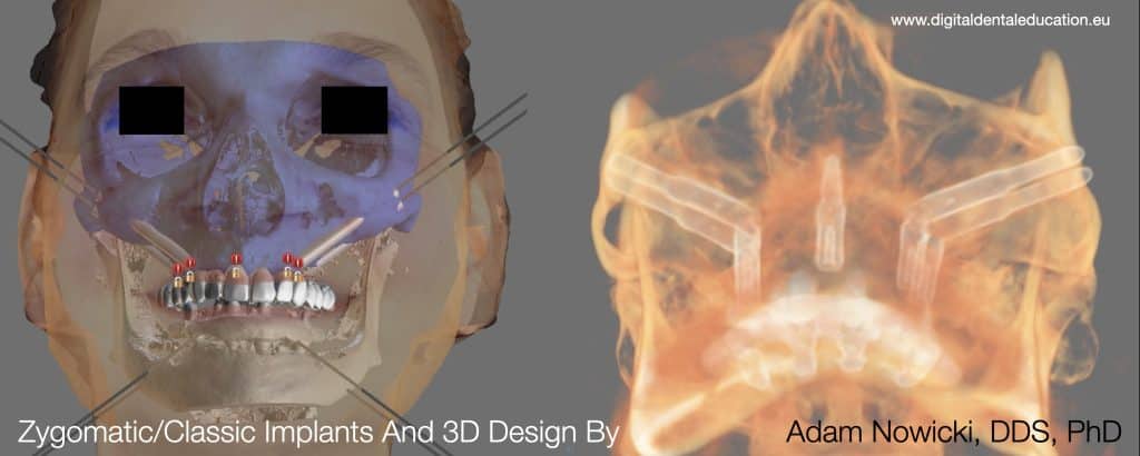 ‎Michalska FULL.‎031