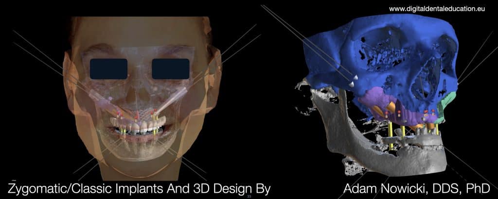‎Michalska FULL.‎033